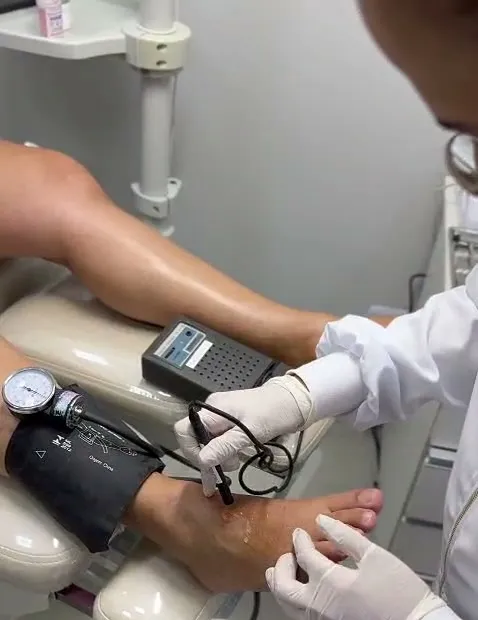 Aferição da pressão arterial no tornozelo durante a consulta podológica